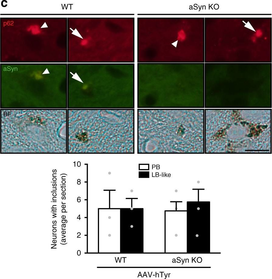 Fig.7.C showing Immunohistochemistry-paraffin-immunofluorescence in a Rattus norvegicus (Rat) sample from the publication: Brain tyrosinase overexpression implicates age-dependent neuromelanin production in Parkinson's disease pathogenesis.