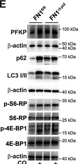 Fig.5.E showing Western Blotting from the publication: Macrophage-derived fibronectin suppresses antitumor immunity via tissue stiffening and immunosuppressive cell induction in cancer mouse models.