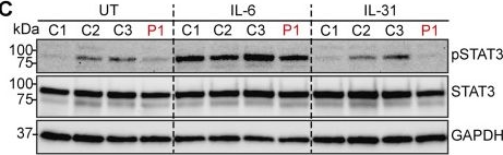 Fig.4.C showing Western Blotting from the publication: Oncostatin M receptor deficiency as a novel candidate genetic cause of autosomal recessive hyper-IgE syndrome.