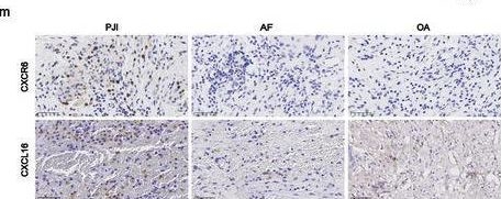 Fig.5.M showing Immunohistochemistry from the publication: CXCL16/CXCR6/TGF-β Feedback Loop Between M-MDSCs and Treg Inhibits Anti-Bacterial Immunity During Biofilm Infection.