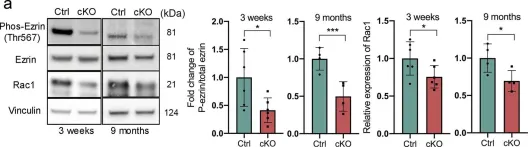 Fig.2.A showing Western Blotting from the publication: βA3/A1-crystallin regulates apical polarity and EGFR endocytosis in retinal pigmented epithelial cells.