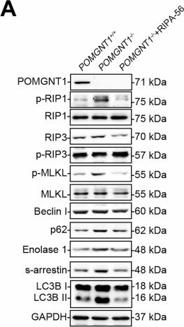 Fig.8.A showing Western Blotting from the publication: Glycosylation-driven necroptosis in retinal degeneration: dual rescue by AAV8 gene therapy and RIPK1 inhibition.