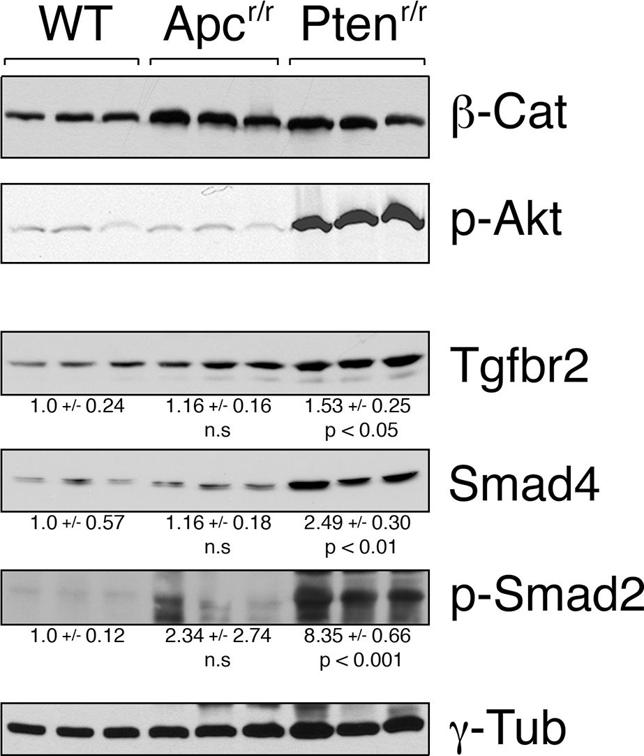 Fig.9.A showing Western Blotting in a Mus musculus (House mouse) sample from the publication: Prostate cancer induced by loss of Apc is restrained by TGFβ signaling.