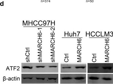 Fig.4.D showing Western Blotting from the publication: MARCH6 promotes hepatocellular carcinoma development through up-regulation of ATF2.