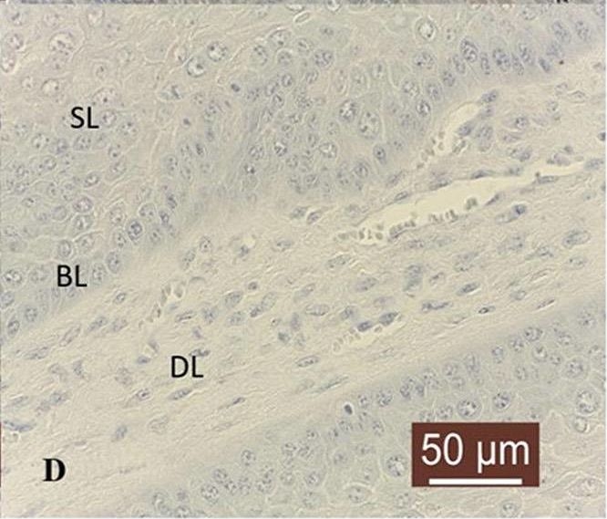 Fig.2.D showing Immunohistochemistry in a Bos taurus (Bovine) sample from the publication: Expression of matrix metalloproteinases (MMPs)-2/-7/-9/-14 and tissue inhibitors of MMPs (TIMPs)-1/-2 in bovine cutaneous fibropapillomas associated with BPV-2 infection.