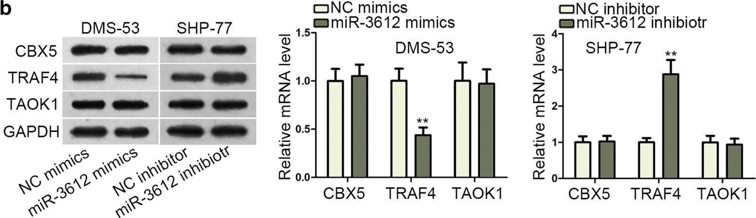 Fig.4.B showing Western Blotting in a Homo sapiens (Human) sample from the publication: YY1-induced lncRNA ZFPM2-AS1 facilitates cell proliferation and invasion in small cell lung cancer via upregulating of TRAF4.