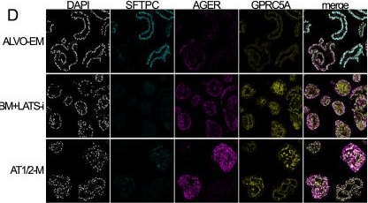 Fig.6.D showing Immunocytochemistry-immunofluorescence in a Homo sapiens (Human) sample from the publication: Interferon-γ selectively promotes survival of alveolar progenitor cells in a human lung organoid model.