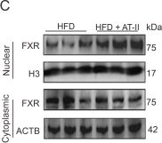 Fig.8.C showing Western Blotting from the publication: Unlocking the potential of atractylenolide II: Mitigating non-alcoholic fatty liver disease through farnesoid X receptor-endoplasmic reticulum stress interplay.