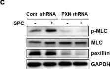 Fig.6.C showing Western Blotting from the publication: Paxillin participates in the sphingosylphosphorylcholine-induced abnormal contraction of vascular smooth muscle by regulating Rho-kinase activation.
