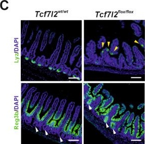 Fig.1.C showing Immunohistochemistry-immunofluorescence from the publication: Tcf4 regulates secretory cell fate decisions in the small intestine and colon tumors: insights from transcriptomic, histological, and microbiome analyses.