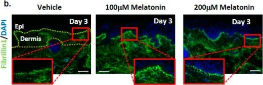 Fig.4.B showing Immunohistochemistry-immunofluorescence in a Homo sapiens (Human) sample from the publication: Melatonin Exerts Prominent, Differential Epidermal and Dermal Anti-Aging Properties in Aged Human Eyelid Skin Ex Vivo.