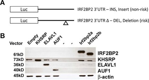 Fig.3.A showing Western Blotting in a Homo sapiens (Human) sample from the publication: IRF2BP2 3'UTR Polymorphism Increases Coronary Artery Calcification in Men.