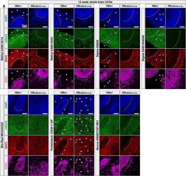 Fig.3.A showing Immunocytochemistry-immunofluorescence in a Homo sapiens (Human) sample from the publication: Evaluation of UBE3A antibodies in mice and human cerebral organoids.