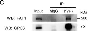 Fig.1.C showing Western Blotting in a Homo sapiens (Human) sample from the publication: Identification of the atypical cadherin FAT1 as a novel glypican-3 interacting protein in liver cancer cells.