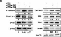 ZO-1 Antibody | Cell Signaling Technology