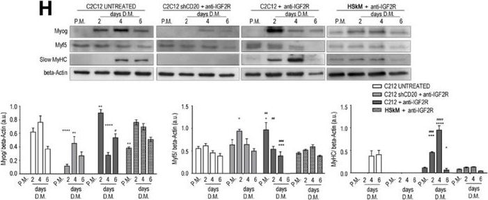 Fig.2.H showing Western Blotting in a Mus musculus (House mouse) sample from the publication: Blockade of IGF2R improves muscle regeneration and ameliorates Duchenne muscular dystrophy.