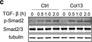 Fig.6.C showing Western Blotting from the publication: Membrane associated collagen XIII promotes cancer metastasis and enhances anoikis resistance.