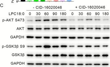 Fig.6.C showing Western Blotting from the publication: LPC18:0 Secreted by Exogenous Neural Stem Cells Potentiates Neurogenesis and Functional Recovery via GPR55-Mediated Signalling in Spinal Cord Injury.