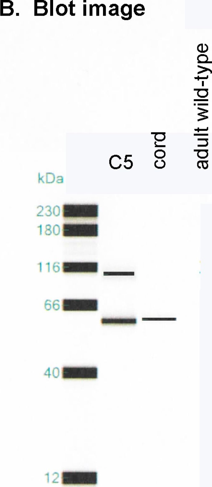 Fig.4.B showing Simple Western - Size in a Homo sapiens (Human) sample from the publication: The C5 Variant of the Butyrylcholinesterase Tetramer Includes a Noncovalently Bound 60 kDa Lamellipodin Fragment.