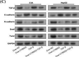 Fig.8.C showing Western Blotting in a Homo sapiens (Human) sample from the publication: CYB5D2 inhibits the malignant progression of hepatocellular carcinoma by inhibiting TGF-β expression and epithelial-mesenchymal transition.