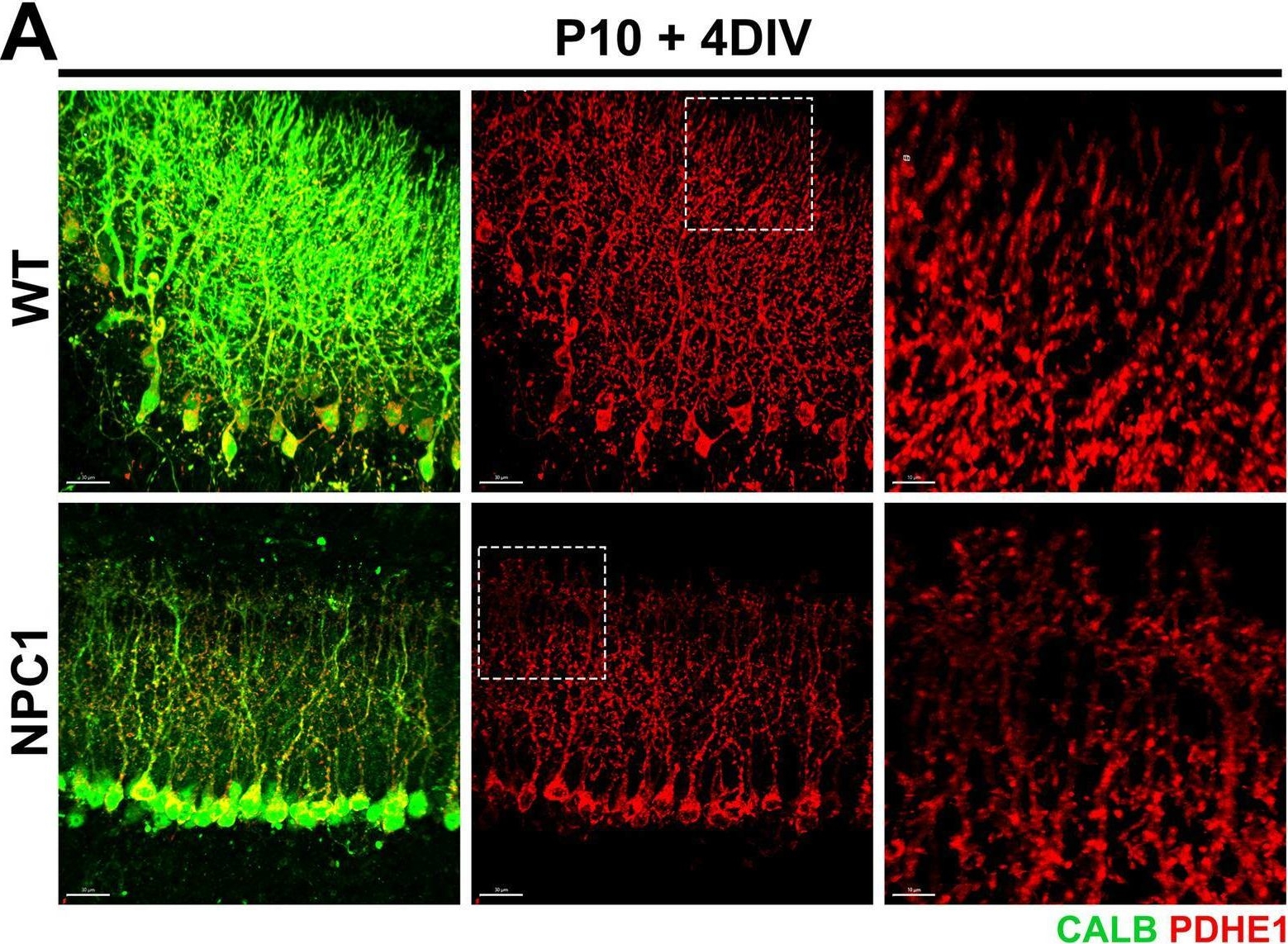 Fig.5.A showing Immunohistochemistry-immunofluorescence from the publication: Trehalose enhances mitochondria deficits in human NPC1 mutant fibroblasts but disrupts mouse Purkinje cell dendritic growth ex vivo.