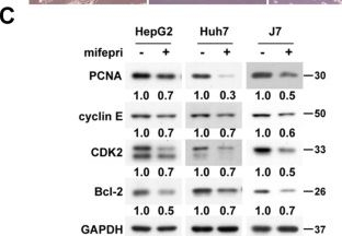 Fig.1.C showing Western Blotting from the publication: Mifepristone inhibits hepatoma growth by enhancing the GR-HSP60-survivin interaction to facilitate survivin degradation.