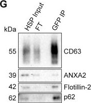 Fig.4.G showing Western Blotting in a Mus musculus (House mouse) sample from the publication: p62 sorts Lupus La and selected microRNAs into breast cancer-derived exosomes.