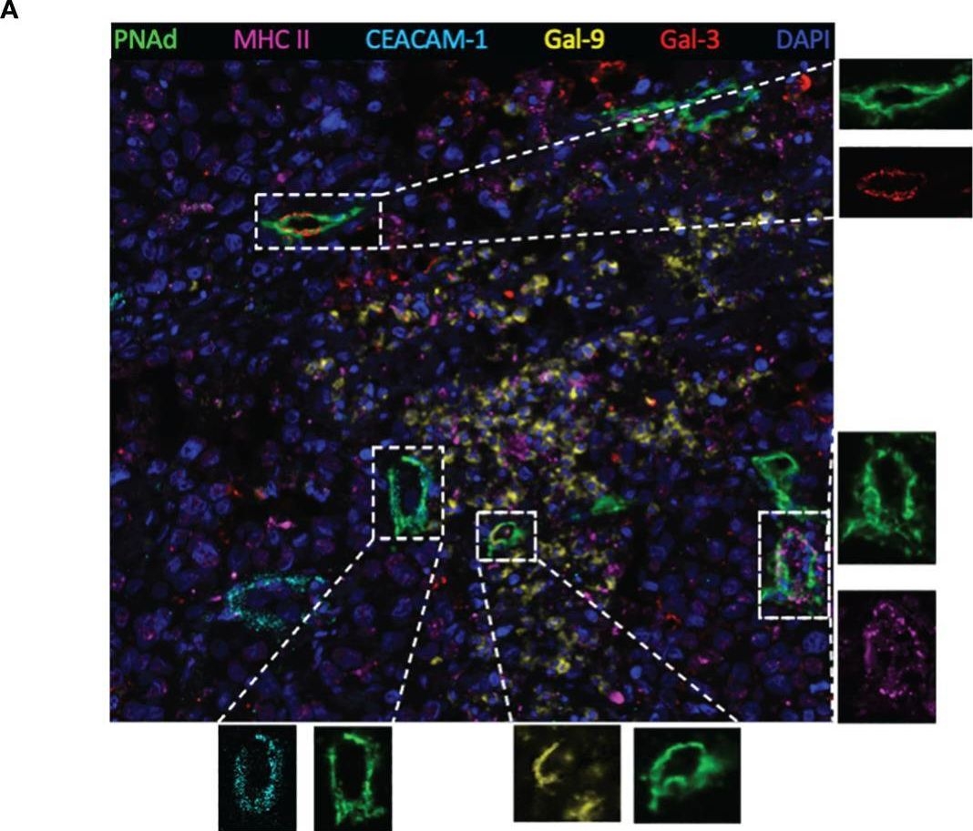 Fig.2.A showing Immunohistochemistry-immunofluorescence in a Homo sapiens (Human) sample from the publication: Immune checkpoint ligands expressed on mature high endothelial venules predict poor prognosis of NSCLC: have a relationship with CD8+ T lymphocytes infiltration.