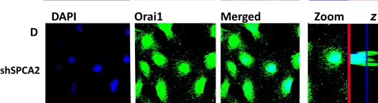 Fig.5.D showing Immunocytochemistry-immunofluorescence in a Mus musculus (House mouse) sample from the publication: SPCA2 regulates Orai1 trafficking and store independent Ca2+ entry in a model of lactation.