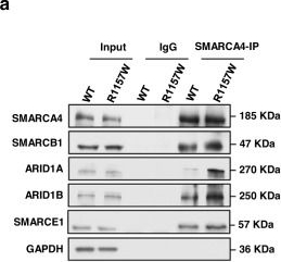 Fig.4.A showing Western Blotting from the publication: The SMARCA4R1157W mutation facilitates chromatin remodeling and confers PRMT1/SMARCA4 inhibitors sensitivity in colorectal cancer.
