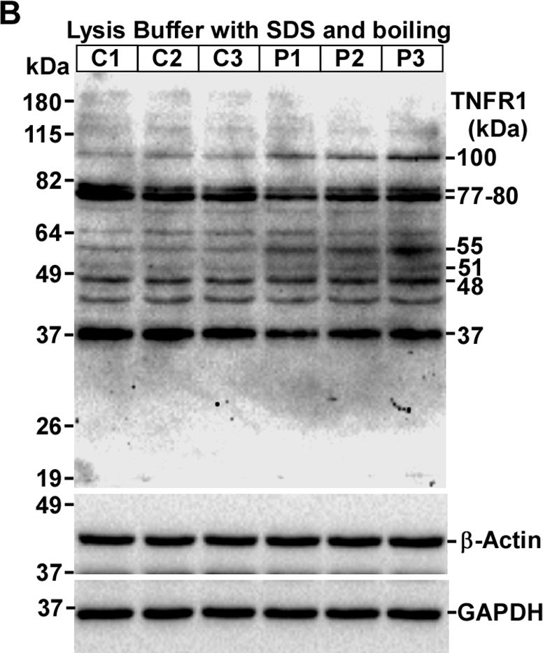 Fig.3.B showing Western Blotting in a Mus musculus (House mouse) sample from the publication: Molecular signatures in prion disease: altered death receptor pathways in a mouse model.
