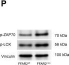 Fig.5.P showing Western Blotting in an Armoracia rusticana (Horseradish) sample from the publication: Loss of SETD2-mediated H3K36me3 Drives CD8+ T Cell Exhaustion in Lung Cancer through CXCL-dependent PMN-MDSC Recruitment and Arginine Deprivation.
