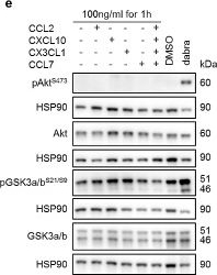 Fig.3.E showing Western Blotting in a Homo sapiens (Human) sample from the publication: Rebound growth of BRAF mutant pediatric glioma cells after MAPKi withdrawal is associated with MAPK reactivation and secretion of microglia-recruiting cytokines.