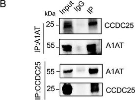 Fig.6.B showing Western Blotting from the publication: Tumor-Derived Alpha-1 Antitrypsin Promotes Liver Metastasis of Colorectal Cancer Through the Neutrophil Extracellular Traps-CCDC25 Pathway.