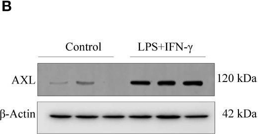 Fig.3.B showing Western Blotting in a Mus musculus (House mouse) sample from the publication: Axl promotes intracranial aneurysm rupture by regulating macrophage polarization toward M1 via STAT1/HIF-1α.
