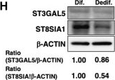 Fig.2.H showing Western Blotting from the publication: PRC2-dependent regulation of ganglioside expression during dedifferentiation contributes to the proliferation and migration of vascular smooth muscle cells.