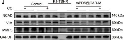 Fig.6.J showing Western Blotting from the publication: Genetically Engineered Cell Membrane-Coated Nanodrug for Targeted Treatment of Thyroid Cancer.