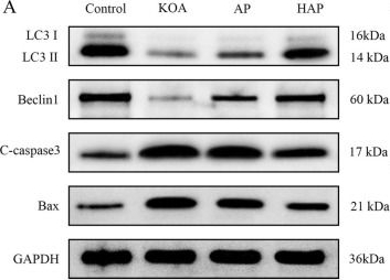 Fig.7.A showing Western Blotting from the publication: Uncovering the mechanisms of homologous point acupuncture on knee osteoarthritis through an integrated study of metabolomics and proteomics.