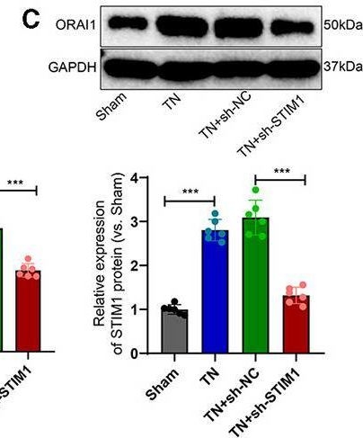 Fig.4.C showing Western Blotting in a Rattus norvegicus (Rat) sample from the publication: Novel insights into STIM1's role in store-operated calcium entry and its implications for T-cell mediated inflammation in trigeminal neuralgia.