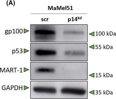 Fig.3.A showing Western Blotting in a Homo sapiens (Human) sample from the publication: Loss of p14 diminishes immunogenicity in melanoma via non-canonical Wnt signaling by reducing the peptide surface density.