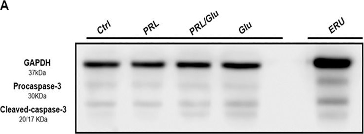Fig.3.A showing Western Blotting in a Rattus norvegicus (Rat) sample from the publication: Prolactin-induced neuroprotection against glutamate excitotoxicity is mediated by the reduction of [Ca2+]i overload and NF-κB activation.