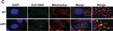 MPV17L2 is required for ribosome assembly in mitochondria.