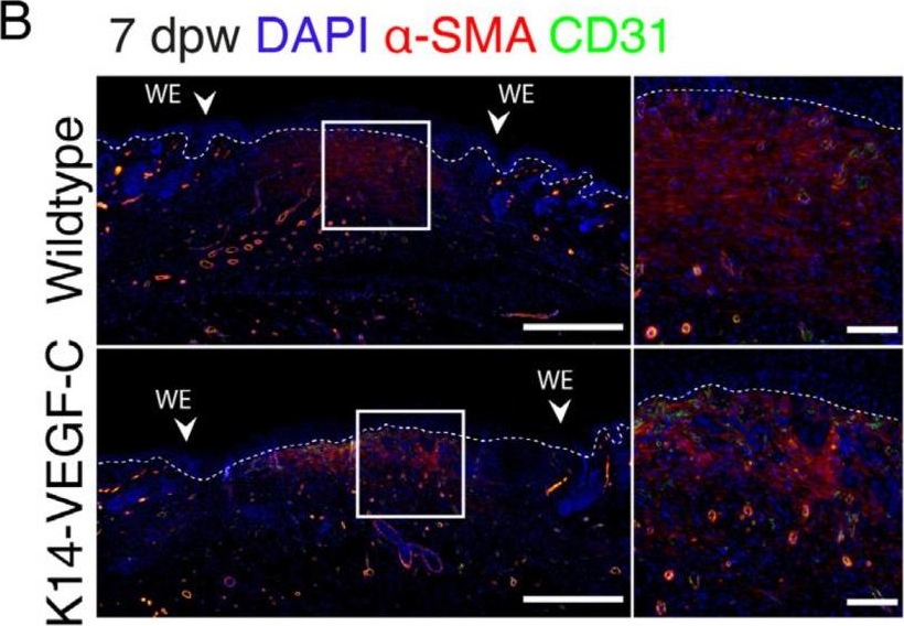 Fig.4.B showing Immunocytochemistry-immunofluorescence in a Cricetulus griseus (Chinese hamster) sample from the publication: Promotion of Lymphangiogenesis by Targeted Delivery of VEGF-C Improves Diabetic Wound Healing.