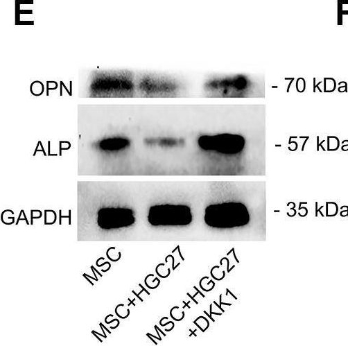 Fig.7.E showing Western Blotting from the publication: Primary cilia regulate gastric cancer-induced bone loss via cilia/Wnt/β-catenin signaling pathway.