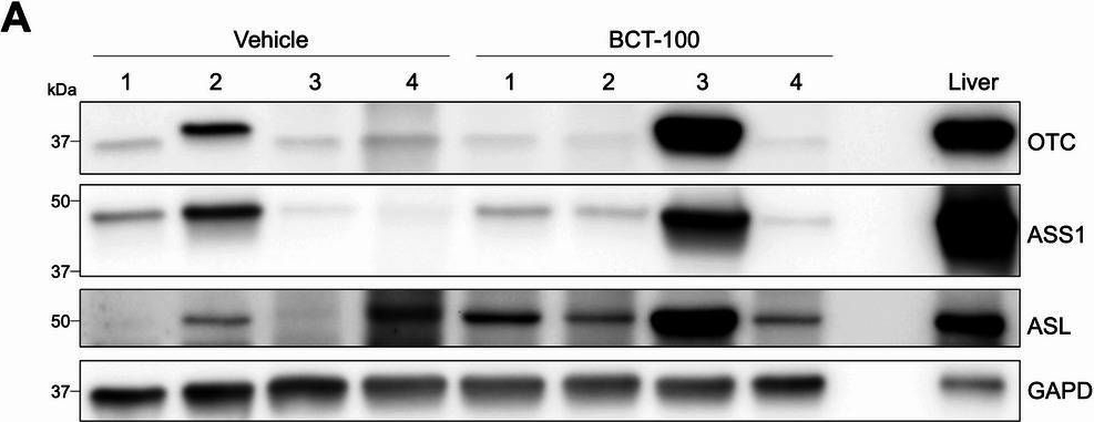 Fig.4.A showing Western Blotting in a Mus musculus (House mouse) sample from the publication: Arginine depletion potentiates standard-of-care chemo-immunotherapy in preclinical models of high-risk neuroblastoma.