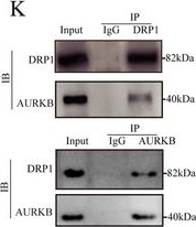 Fig.4.K showing Western Blotting from the publication: Targeted Extracellular Vesicles Deliver Asiaticoside to Inhibit AURKB/DRP1-Mediated Mitochondrial Fission and Attenuate Hypertrophic Scar Formation.