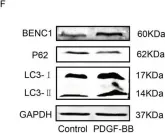Fig.5.F showing Western Blotting in a Homo sapiens (Human) sample from the publication: Myocardin/microRNA-30a/Beclin1 signaling controls the phenotypic modulation of vascular smooth muscle cells by regulating autophagy.