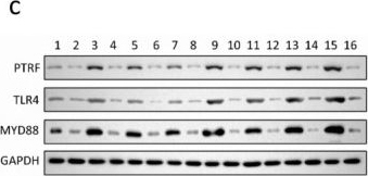 Fig.8.C showing Western Blotting from the publication: Compound Augmentation of Myocardial Injury in a Rat Model of Coronary Heart Disease Induced by Ischemia/Reperfusion, Rheumatoid Arthritis, and High-Fat Diet: A Molecular Mechanistic Study.