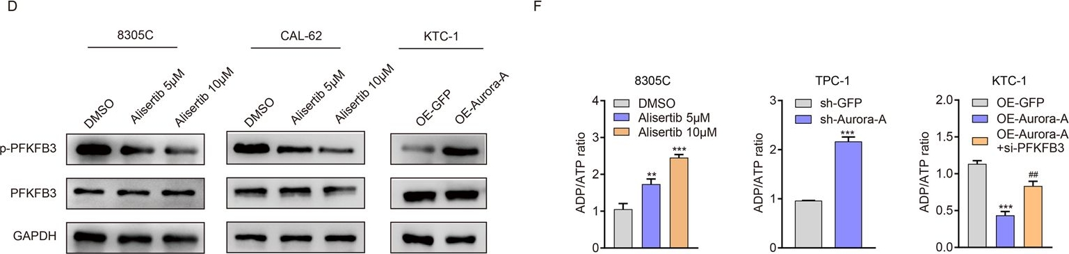 Fig.4.D showing Western Blotting in a Homo sapiens (Human) sample from the publication: Targeting Aurora-A inhibits tumor progression and sensitizes thyroid carcinoma to Sorafenib by decreasing PFKFB3-mediated glycolysis.