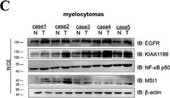 Fig.9.C showing Western Blotting from the publication: Musashi-1 and miR-147 Precursor Interaction Mediates Synergistic Oncogenicity Induced by Co-Infection of Two Avian Retroviruses.